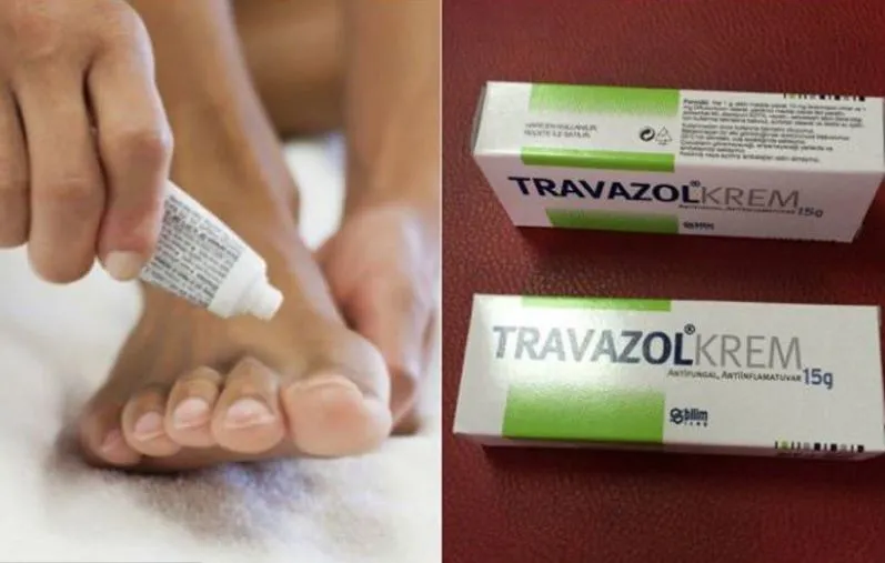 Travazol Krem Ne İşe Yarar? Travazol Krem Ne İçin Kullanılır?